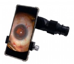 Smartphone Video Adapter
